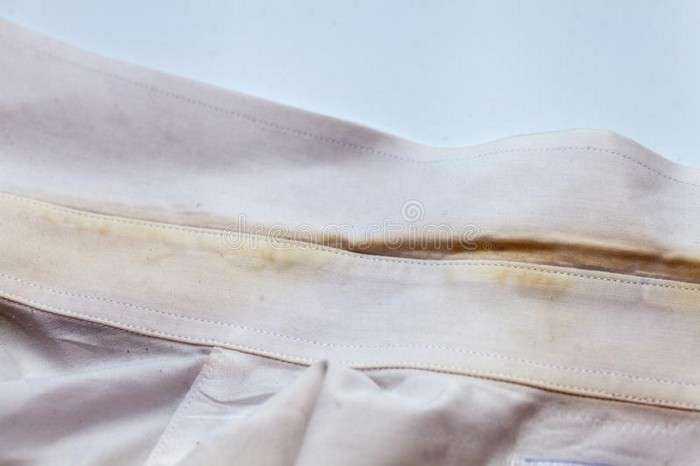 Воротник рубашки: как отстирать от желтой полоски, чем отбелить от засаленности