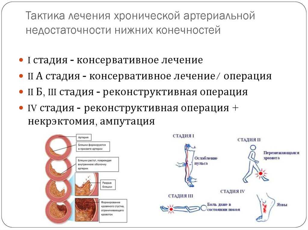 Как выбрать шорты для бега